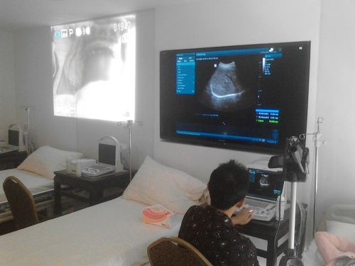 Kursus Pelatihan  USG Dasar Obstetri Untuk Bidan Dan Dokter Umum Di Semarang